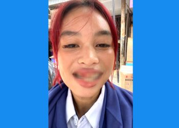 Kasus penganiayaan dialami Audy, petugas retribusi parkir.