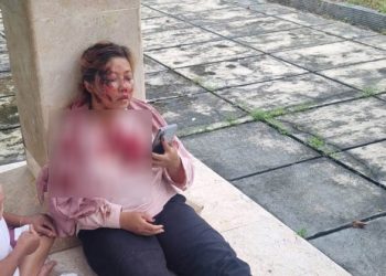Jadi Korban Begal, Wanita Ini Alami Luka Serius