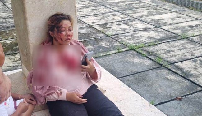 Jadi Korban Begal, Wanita Ini Alami Luka Serius